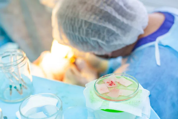 Skallighet behandling. Hårtransplantation. Kirurger i operationssalen utför hår transplantationskirurgi. Kirurgisk teknik som flyttar hårsäckarna från en del av huvudet. — Stockfoto