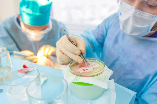 Tratamiento de la calvicie. Trasplante de cabello. Los cirujanos en el quirófano llevan a cabo una cirugía de trasplante de cabello. Técnica quirúrgica que mueve los folículos pilosos de una parte de la cabeza . — Foto de Stock