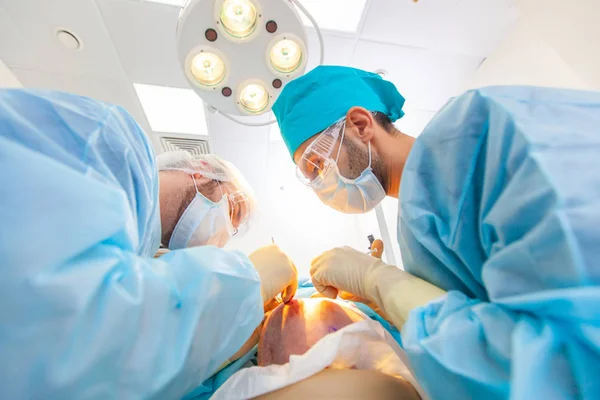 대머리 치료. 모발 이식. 수술실에서 외과 의사는 모발 이식 수술을 수행합니다. 머리의 부분에서 모낭을 이동하는 외과 기술. — 스톡 사진