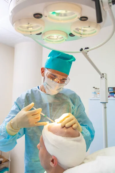 The surgeon gives injections to the head. Baldness treatment. Hair transplant. Surgeons in the operating room carry out hair transplant surgery. Surgical technique that moves hair follicles from a