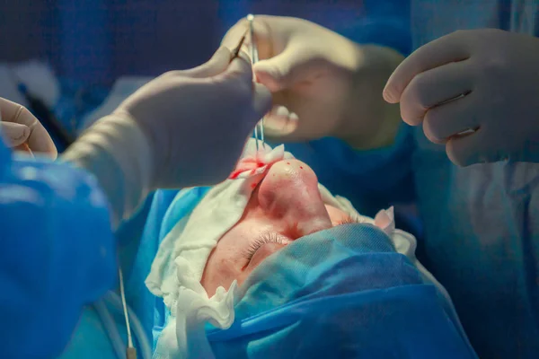 Kirurg och hans assistent utför kosmetisk kirurgi på näsan i sjukhuset operationssalen. Näsa omforma, augmentation. Näsplastik. — Stockfoto