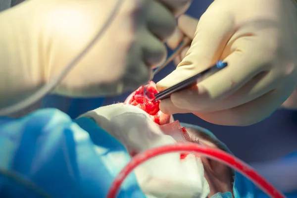 Surgeon and his assistant performing cosmetic surgery on nose in hospital operating room. Nose reshaping, augmentation. Rhinoplasty. — Stock Photo, Image