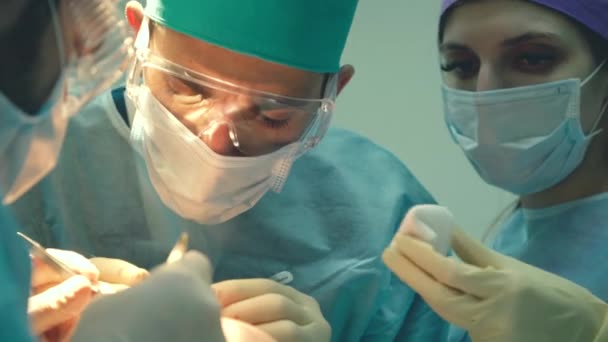 대머리 치료. 모발 이식. 수술실에서 외과 의사는 모발 이식 수술을 수행합니다. 머리의 부분에서 모낭을 이동하는 외과 기술. — 비디오