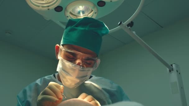 Baldness treatment. Hair transplant. Surgeons in the operating room carry out hair transplant surgery. Surgical technique that moves hair follicles from a part of the head. — Stock Video