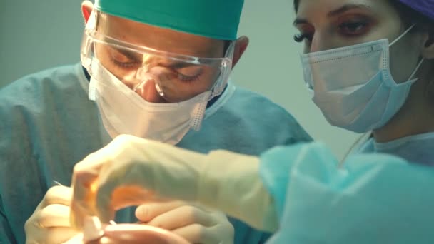 대머리 치료. 모발 이식. 수술실에서 외과 의사는 모발 이식 수술을 수행합니다. 머리의 부분에서 모낭을 이동하는 외과 기술. — 비디오
