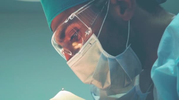 Kaalheid behandeling. Haartransplantatie. Chirurgen in de operatiekamer voeren haartransplantatiechirurgie uit. Chirurgische techniek die haarfollikels van een deel van het hoofd beweegt — Stockvideo