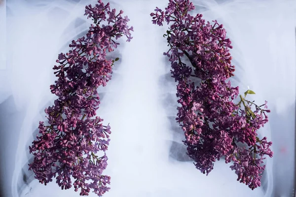 Una Radiografia Dei Polmoni Cui Crescono Fiori Lilla Concetto Medico — Foto Stock