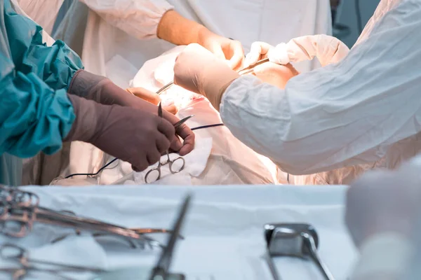 Strumenti Chirurgici Tavolo Sterile Sala Operatoria Chirurghi Lavorano Con Mani — Foto Stock