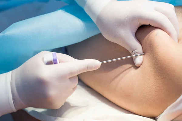 Uzun iğne kullanan bir onkolog, çocuklarda lösemi, Ewing sarkomu ve kemik iltihabı hastalığı teşhisi koymak için ileumu delmiş. Kemik kanseri teşhisi Pediatrik onkoloji