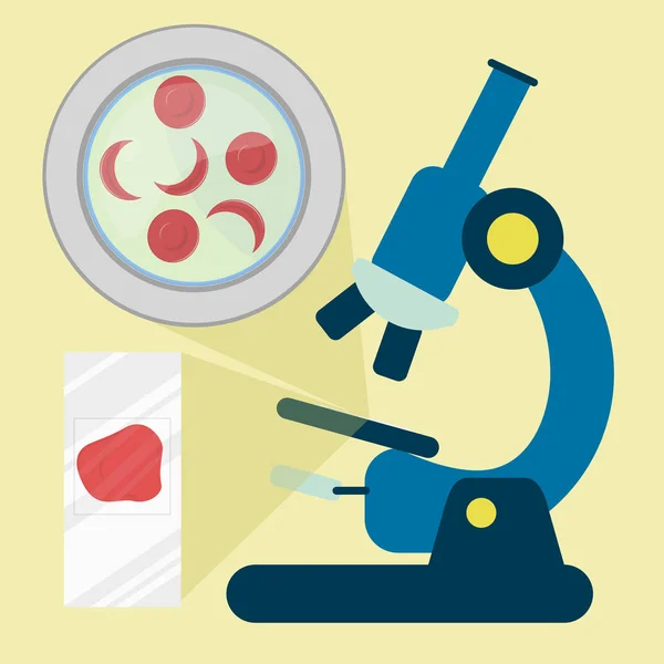 鎌状赤血球を持つ赤血球を示す顕微鏡下の血液サンプル 血液サンプルが付いている顕微鏡スライド — ストックベクタ
