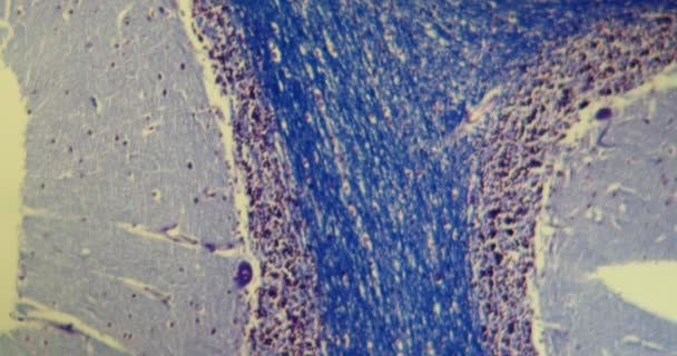 Cerebellum avec cellules nerveuses au microscope