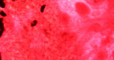 Büyük karaciğer, memelilerde tehlikeli bir parazit olarak görülür.