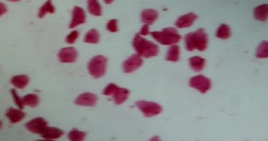 Ağız mukozasında hücre çekirdeği ve mikroskop altında bakteri lekeleri var.