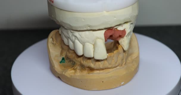 上顎にインプラントを施した石膏製の入れ歯の印象 — ストック動画