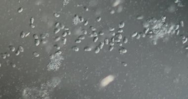 Atık sudan elde edilen bakteri ve bakteriler yüksek büyütme ile mikroskop altında hareket ederler.