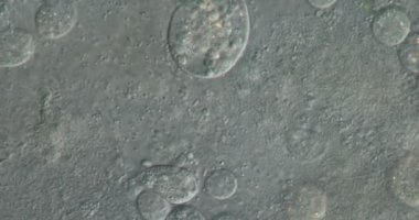 Atık sudan elde edilen bakteri ve bakteriler yüksek büyütme ile mikroskop altında hareket ederler.