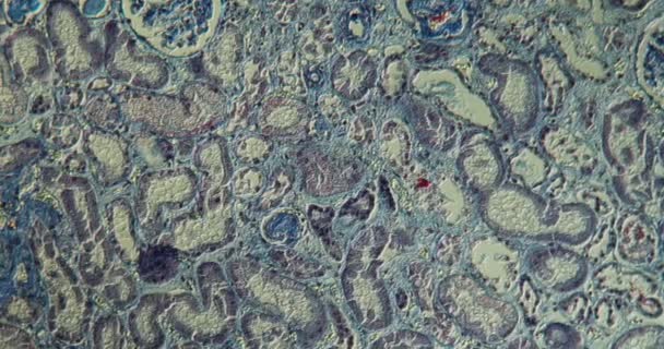 Böbrek Insan Dokusu Mikroskop Altında 100 Kat Büyütülmüş — Stok video