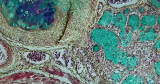 Maladie Tissulaire Avec Asthme Microscope 100X — Video