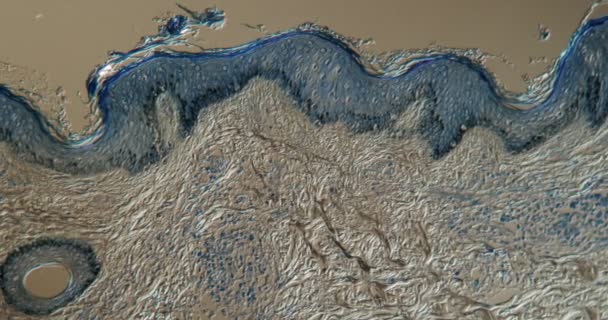 Tissu Cutané Lèpre Magnifié 100X Microscope — Video