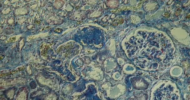 顕微鏡下で高倍率のフィブリン組織を持つ腎臓100倍 — ストック動画