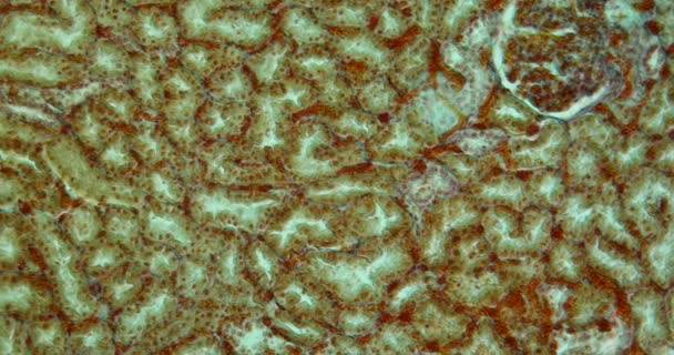 Желтуха Почек Желтуха Ткани Высоком Увеличении Микроскопом 100X — стоковое видео