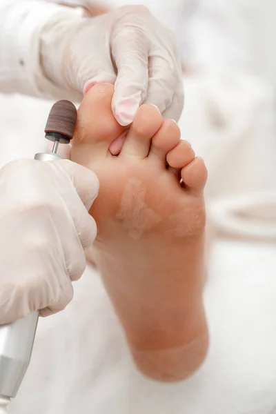 Professional Podiatrist Polish Callus Corn Skin Feet Young Woman Device — Stock Photo, Image