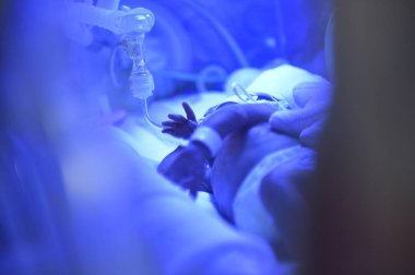 İlk gün kuluçka annelik Kliniği, yeni doğan bebek