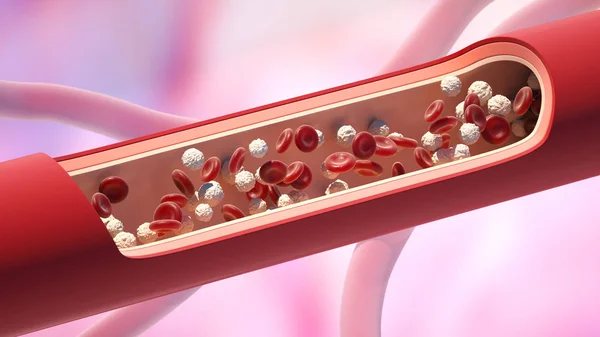 Κόκκινα και λευκά αιμοσφαίρια στη φλέβα. Υψηλό επίπεδο λευκοκυττάρων — Φωτογραφία Αρχείου