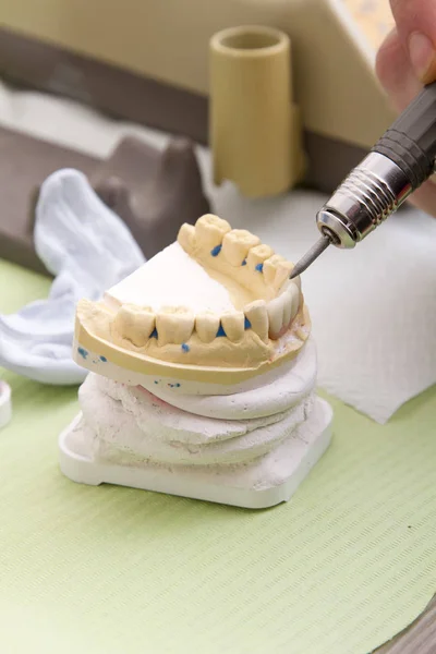 Bir Dişçi Diş Office Işyerinde Çalışan Kısmi Görünümü — Stok fotoğraf