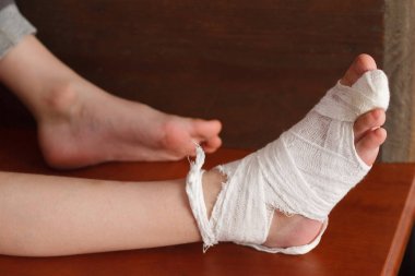Ayak bandaj - genç çocuk evde bir kapı ile ayağını zarar