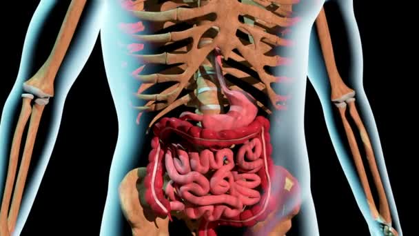 这段录像显示胃部溃疡的形成 — 图库视频影像
