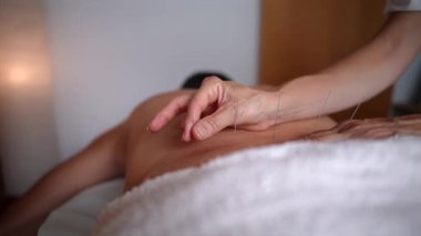 Female acupuncturist performing a treatment by inserting thin needles into a patient's back, a traditional chinese medicine practice for pain relief, healing, and relaxation in a spa
