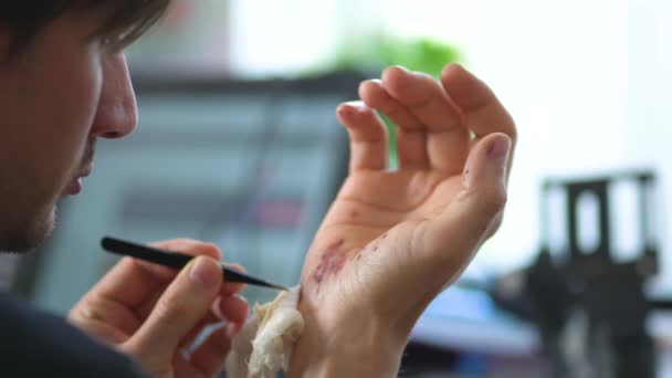 Uomo che pulisce una ferita sanguinante sotto la pelle dopo l'incidente. Trattamento e disinfezione delle ferite profonde. — Video Stock