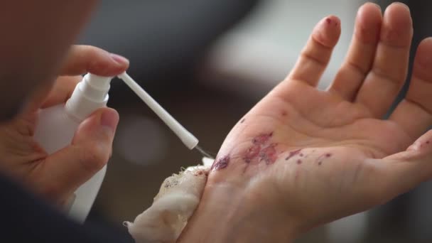 Man cleaning a bleeding wound under the skin after the accident. Treatment and disinfection of deep wounds. — Stock Video