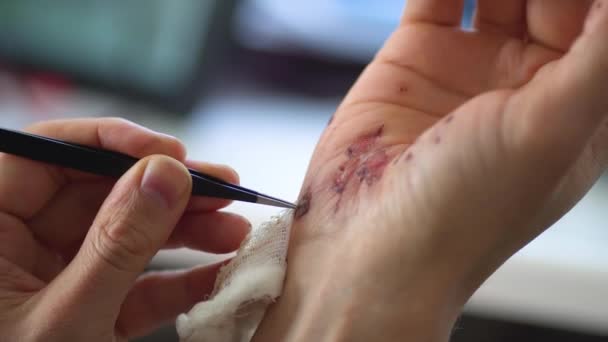 Hombre limpiando una herida sangrante debajo de la piel después del accidente. Tratamiento y desinfección de heridas profundas . — Vídeo de stock