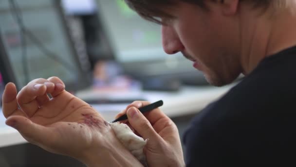 Mannen som rengör ett blödande sår under huden efter olyckan. Behandling och desinfektion av djupa sår. — Stockvideo