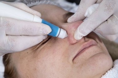 Orta yaşlı bir kadın portre burun sivilce sıkma güzellik uzmanı