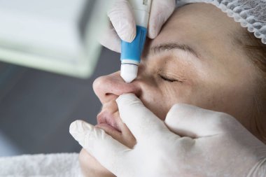 Orta yaşlı bir kadın portre burun sivilce sıkma güzellik uzmanı