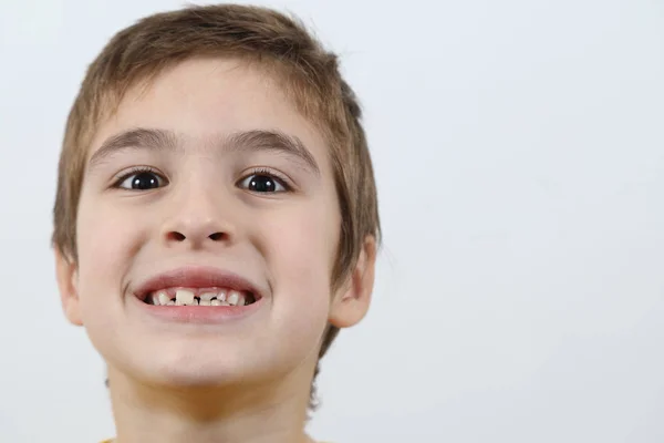 Tête Petit Garçon Montrant Des Dents Lait Des Dents Permanentes — Photo