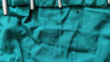 Jaipur, Hindistan 3 Mart 2024: Bir cerrahın ameliyathanede kullandığı aletlerin görüntüleri