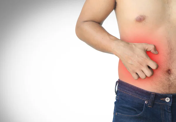 Hombre Mano Rascarse Una Picazón Piel Sensible Marca Roja Sobre — Foto de Stock