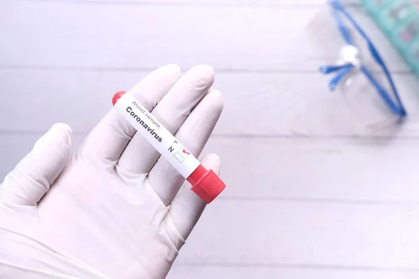 laboratory technician hand holding blood test tube