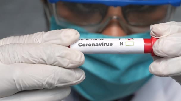 Técnico de laboratorio mano sosteniendo tubo de análisis de sangre — Vídeos de Stock