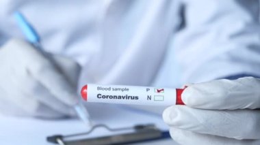 Laboratuvar teknisyeni elinde kan testi tüpü tutuyor. 