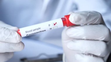 Laboratuvar teknisyeni elinde kan testi tüpü tutuyor. 
