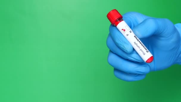 Laboratory technician hand holding blood test tube against green background — Stock Video