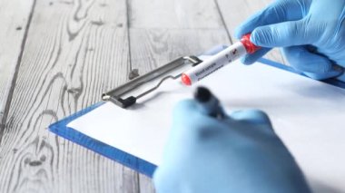Laboratuvar teknisyeni elinde kan testi tüpü ve kağıda yazı tutuyor. 