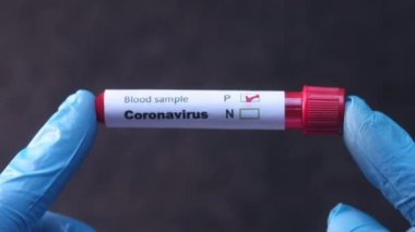 Laboratuvar teknisyeni elinde kan testi tüpü tutuyor. 