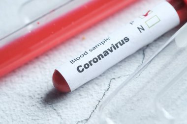 Kan testi tüpü masada. Kapatın. 