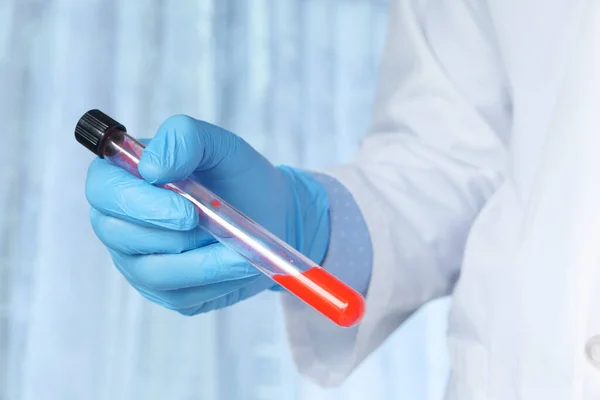 laboratory technician hand holding blood test tube